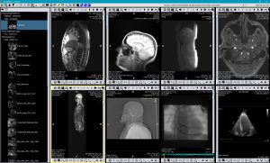 TIMS Medical DICOM System (061000-2000-SP) WIN10